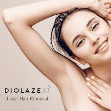 Diolaze Laser Hair Removal - Underarms - Series of 6 Treatments