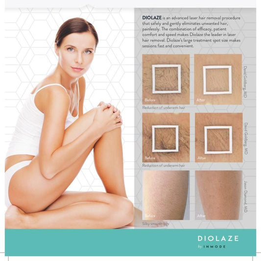 Diolaze Laser Hair Removal - Brazilian - Series of 6 Treatments